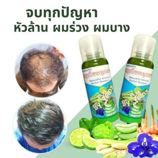 แชมพุสมุนไพรคุณยาย ผมบาง ผมร่วง คัน รังแค เร่งผมเกิดใหม่
