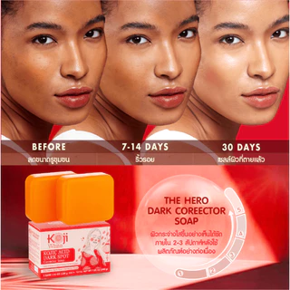 [แถมถุงตีฟอง] Koji White สบู่ผิวขาว Niacinamide ลดรอยสิว ลดฝ้า บำรุงผิว ผสาน Vit C + Kojic Acid 200g