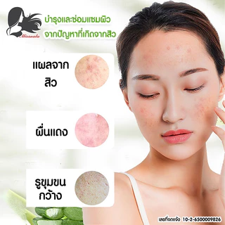 MISSNALA ESSENCE ALOE GEL เนื้อเจล บำรุงผิวและซ่อมแซมผิว จากปัญหาสิว สารสกัดจากว่านหางจระเข้ 99% 248966