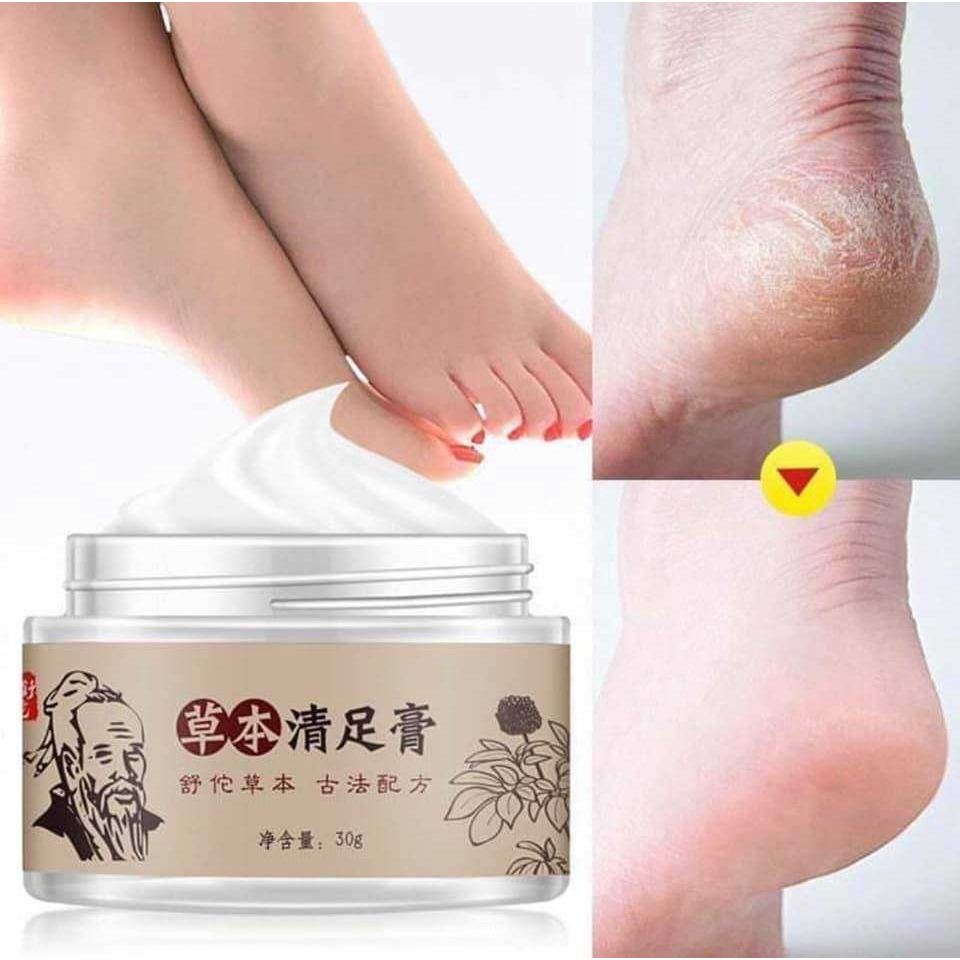 ✅พร้อมส่ง ครีมทาส้นเท้าแตก สารสกัดจากธรรมชาติ หมดอายุ 17/12/2024