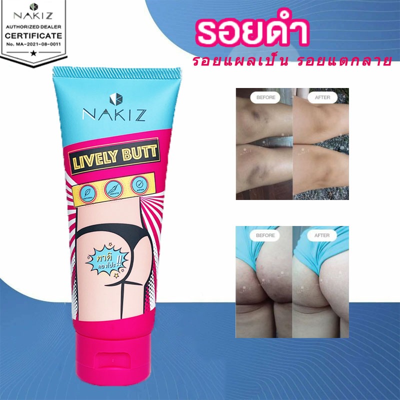 NAKIZ LIVELY BUTT 100g ลบรอยดำขาหนีบ ลบเลือนรอยดำ ลบรอยดำ ขาหนีบดำ หัวเข่าดำ รอยดำ จาก แผล