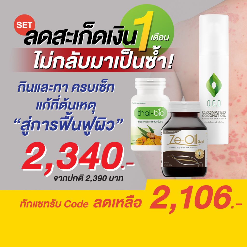 ชุดลดสะเก็ดเงิน กิน+ทา ครบชุด 30 วัน สะเก็ดเงิน ภูมิแพ้ผิวหนัง ผิวหนังอักเสบ ( Ze-oil 180 + พลูคาว 60 + O.C.O.100ml. )