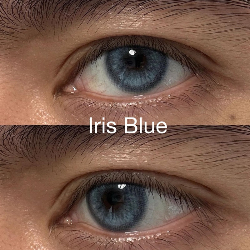 สี Iris Blue คอนแทคเลนส์สายฝอ มีค่าสายตา