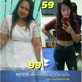 { โปร 3 กล่อง } มาตาเนะสูตรล้มช้าง ลดจริง ลดไว ไม่โย่