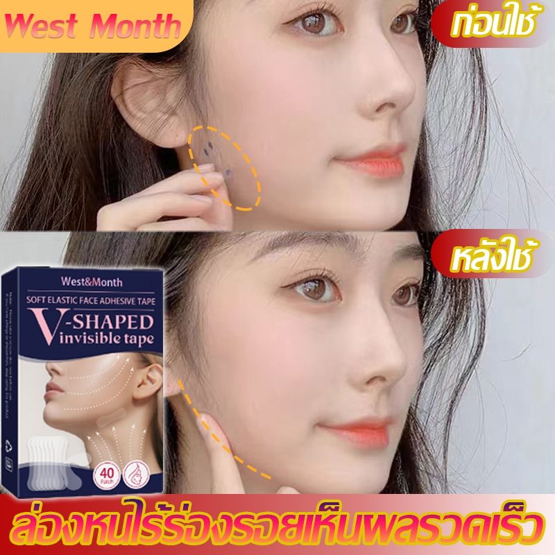 สำหรับยกกระชับหน้าลด West Month ที่ดึงหน้า 40ชิ้น ที่รัดหน้าเรียว ​หน้าเรียว เทปดึงหน้า ยกกระชับหน้า แผ่นแปะหน้าเรียว