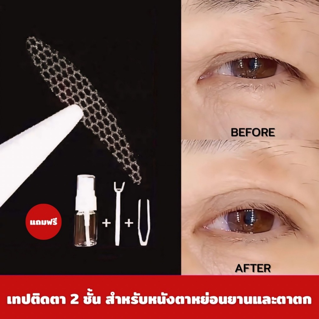 เทปตาข่ายติดตาสองชั้น รูปหยดน้ำ เหมาะสำหรับแก้ไขดวงตาหย่อนคล้อย หนังตาเยอะ หางตาตก จำนวน 240 ชิ้น พร้อมอุปกรณ์ครบชุด