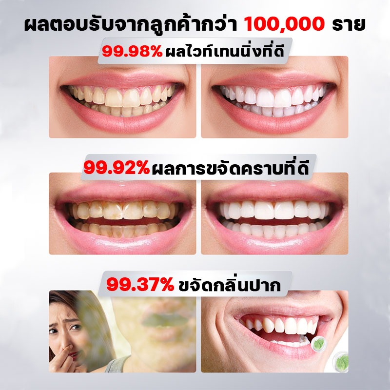 SP-14 ยาสีฟันไวท์เทนนิ่ง ยาสีฟันเบกกิ้งโซดา ขจัดคราบหินปูนสีเหลือง เพิ่มความแข็งแรงฟัน ซ่อมแซมฟัน ยาสีฟันฟันขาว - รูปที่ 6