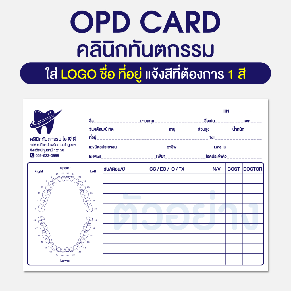 OPD CARD คลินิกทันตกรรม เวชระเบียน ใบประวัติคนไข้ คลินกทำฟัน