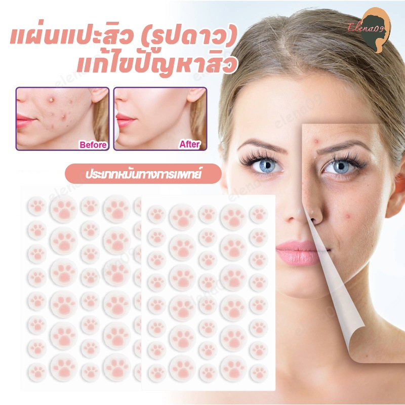 น่ารักแผ่นแปะสิว แผ่นแปะดูดสิว แผ่นดูดสิว แผ่นสิว สําหรับติดตกแต่งสิว แต่งหน้าเนียน น่ารัก สีสันสดใส