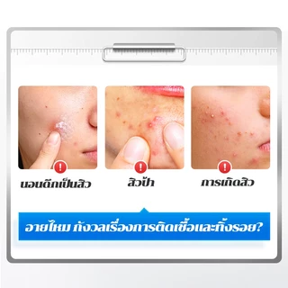 แผ่นสติกเกอร์แปะสิว แผ่นสิว สําหรับติดตกแต่งสิว แผ่นแปะดูดสิว แผ่นดูดสิว น่ารักแผ่นแปะสิว น่ารัก