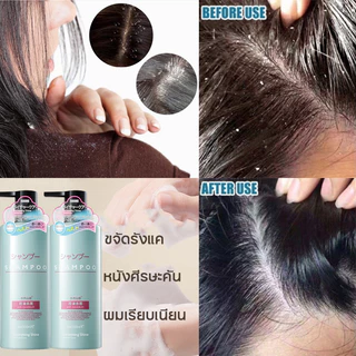ยาสระผม ยาสระผมขจัดรังแค แชมพูแก้คัน 500ml ยาสระผมผมร่วง ควบคุมความมัน ขจัดรังแค ลดผมร่วง บํารุงรากผม