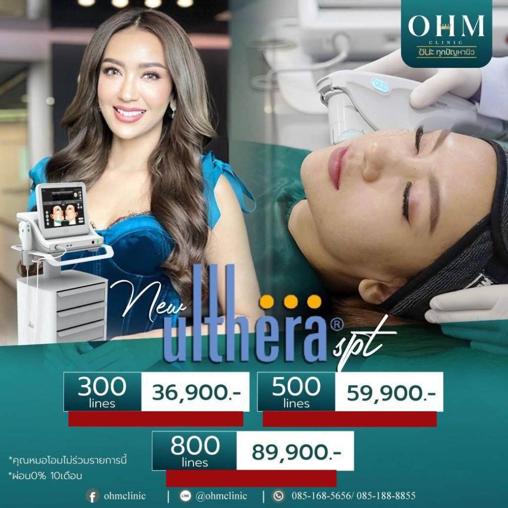ULTHERA ย้อนวัยผิว ปรับรูปหน้า