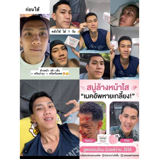 สบู่เอวาน่า สูตรกุหลาบน้ำผึ้ง ลดสิว หน้าขาวกระจ่างใส [AVANA IP BRIGHT ของแท้บริษัท]