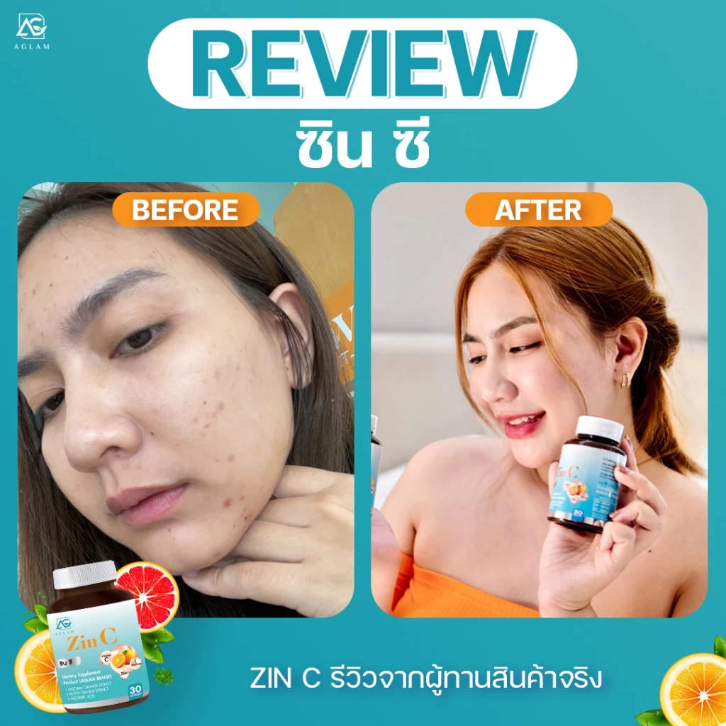 ┃สินค้าแท้มีบัตร┃🩵 Zinc Aglam อะแกรม ซิงค์ ริ้วรอย บำรุงผิว กลูต้า สิว วิตามินผิว ซินซี ขาว ดี Zin C thumbnail 9