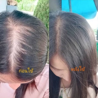 แชมพู1ฟรี1 ใช้สระผมทุกวันได้ ปราสจากสีไม่มีพราเบน