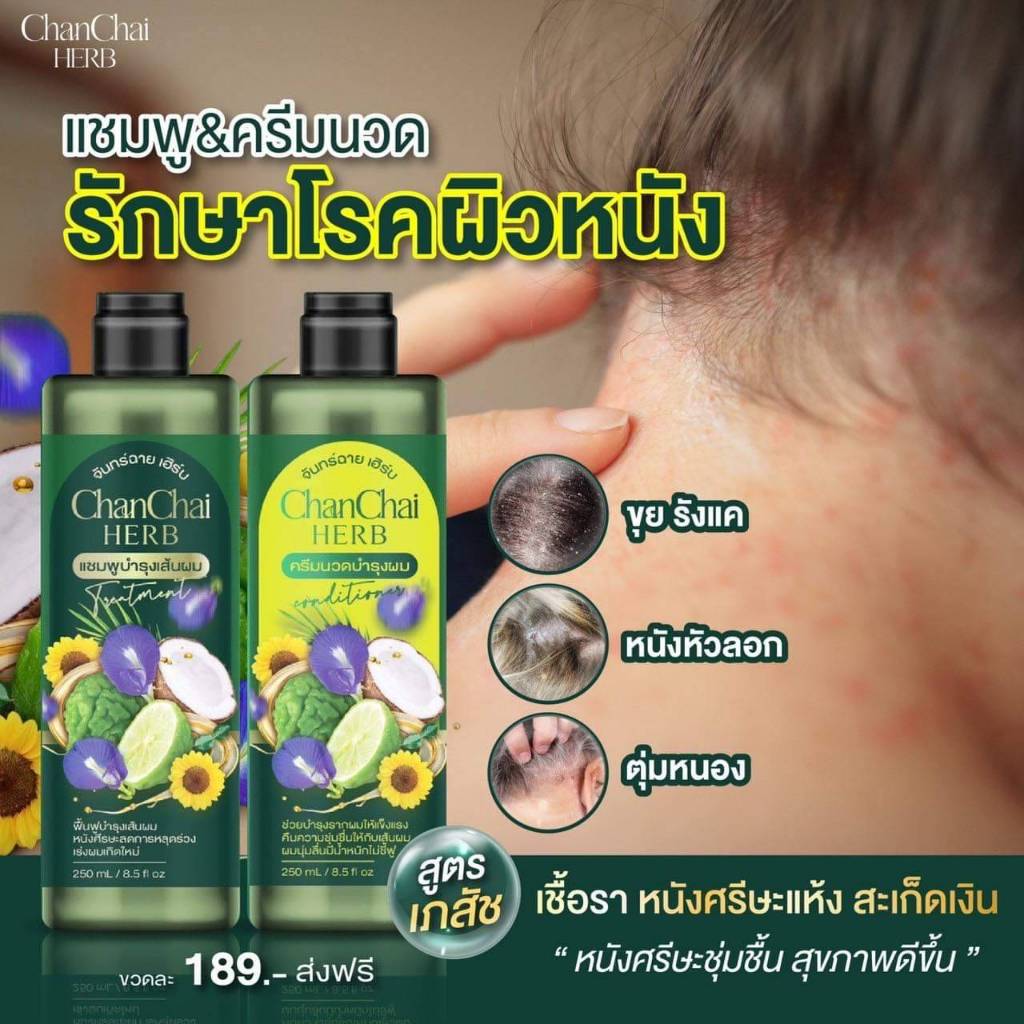 แชมพูจันทร์ฉาย เฮิร์บ Chan Chai แชมพูหยุดผมร่วงหยุดหงอกปลูกผมทำให้ผมดกดำ 250 มล จัดส่งฟรี