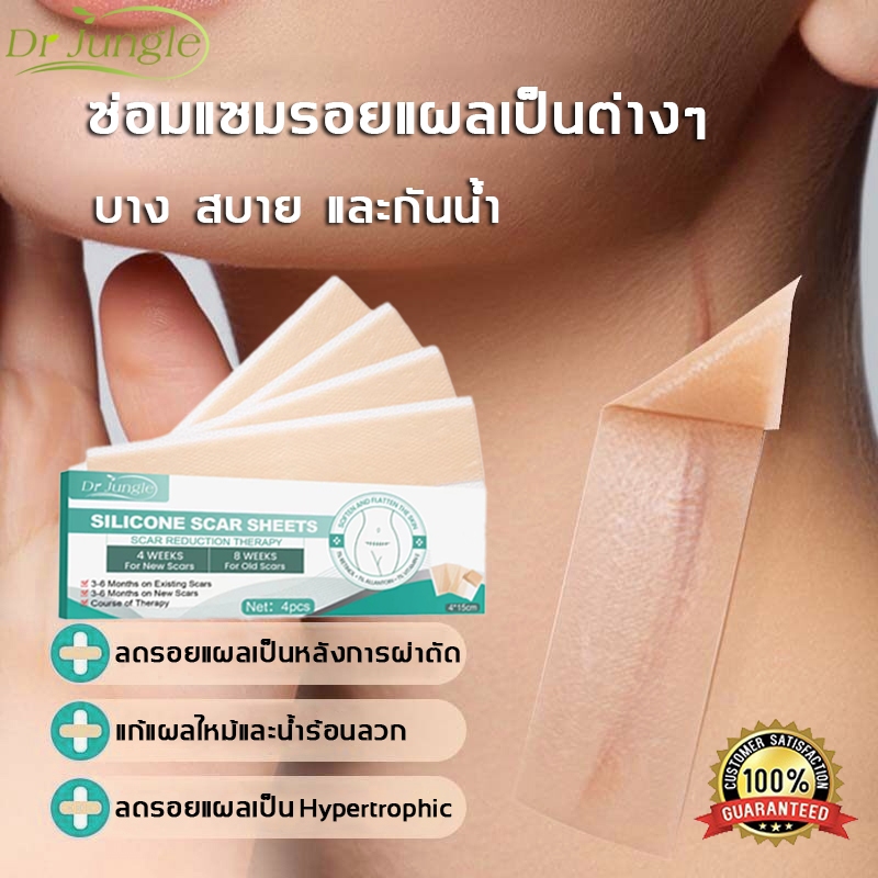 【ลบรอยแผลเป็น】✨Dr.Jungle แผ่นแปะลดรอยแผลเป็น แผ่นแปะแผลเป็น 4แผ่น/กล่อง ลบรอยแผลเป็นแผลผ่าตัด น้ำร้อนลวก เผยผิวเนียนสวย