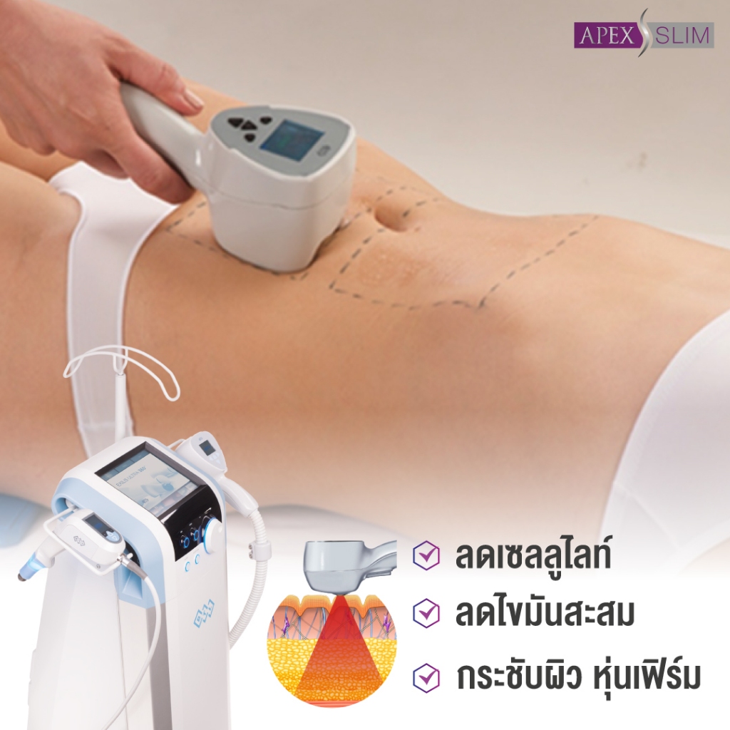 [E-Voucher] APEX โปรแกรม Fit Firm ยกกระชับ ลดไขมันส่วนเกิน พุง ต้นขา หุ่นเฟิร์ม ทดลอง 1 ครั้ง - รูปที่ 2