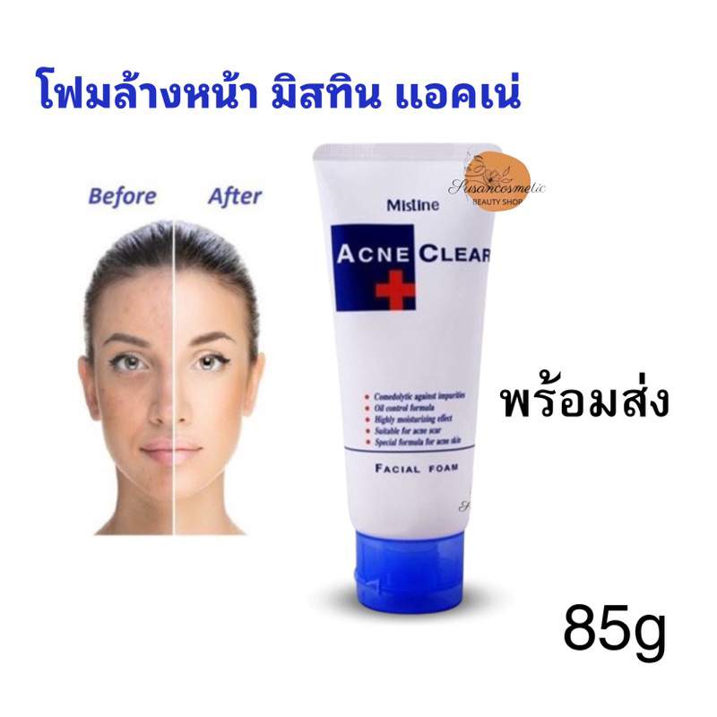 Mistine Acne Clear โฟมล้างหน้า มิสทิน แอคเน่ เคลียร์ เฟเชี่ยล โฟม 85g