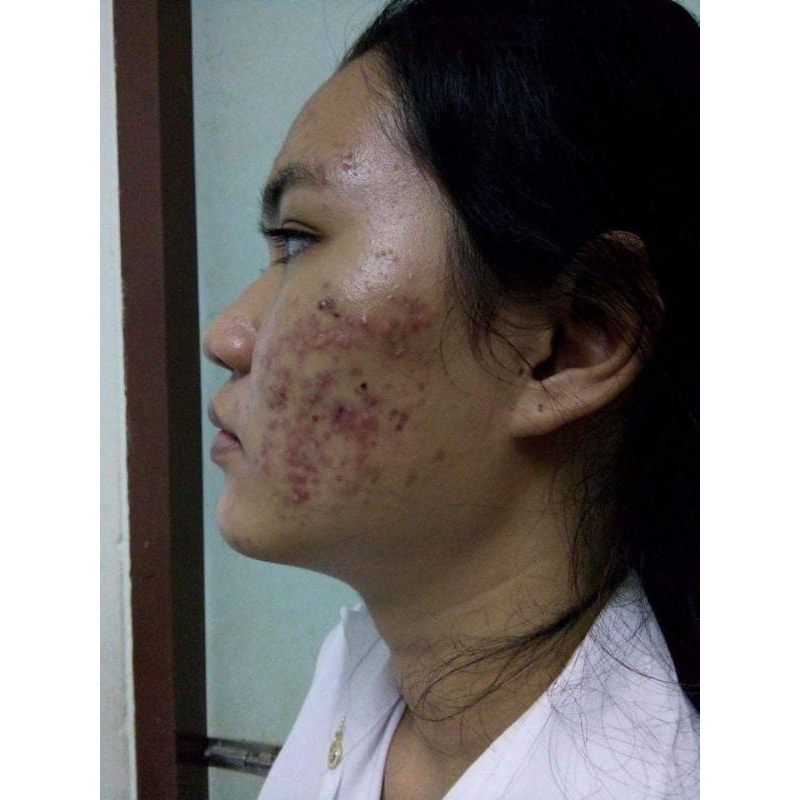 คุณนายaloe vera Salem