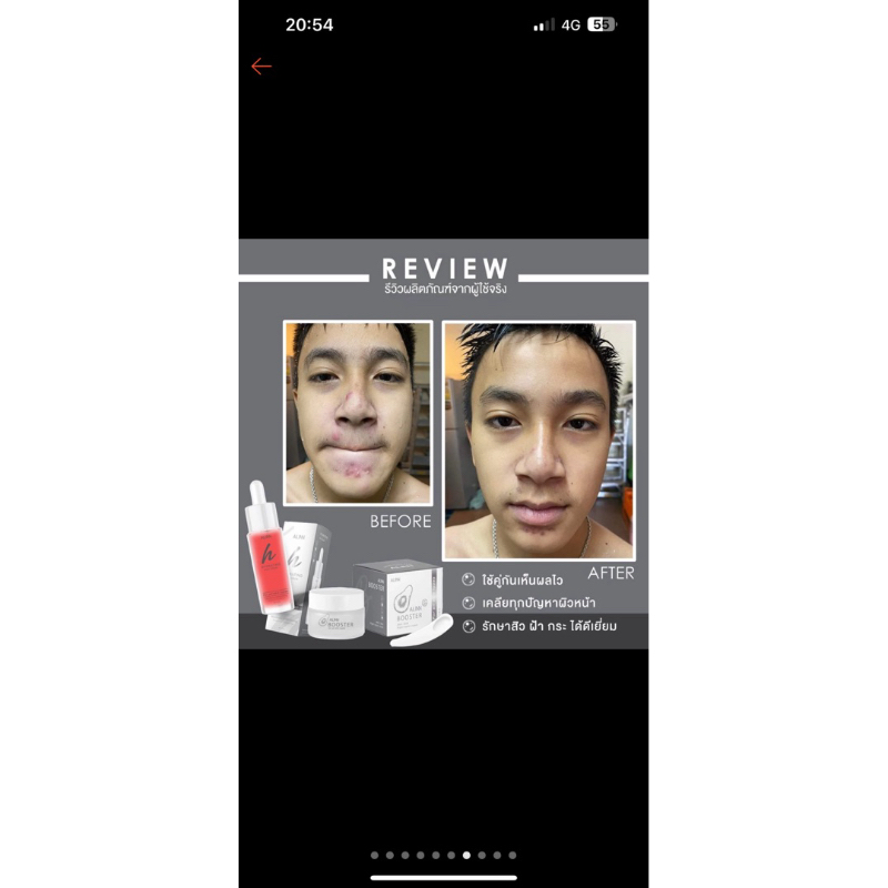 Alinbooster เซรั่มอลินบูทเตอร์ รูปที่ 7