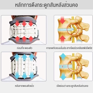 เครื่องปรับดึงกระดูกคอแพทย์บำบัดเครื่องดึงยืดเติมลมปรับฐานกระดูกคอเครื่องดึงกระดูกคอ อุปกรณ์แก้ไขกระดูกสันหลังส่วนคอ การ