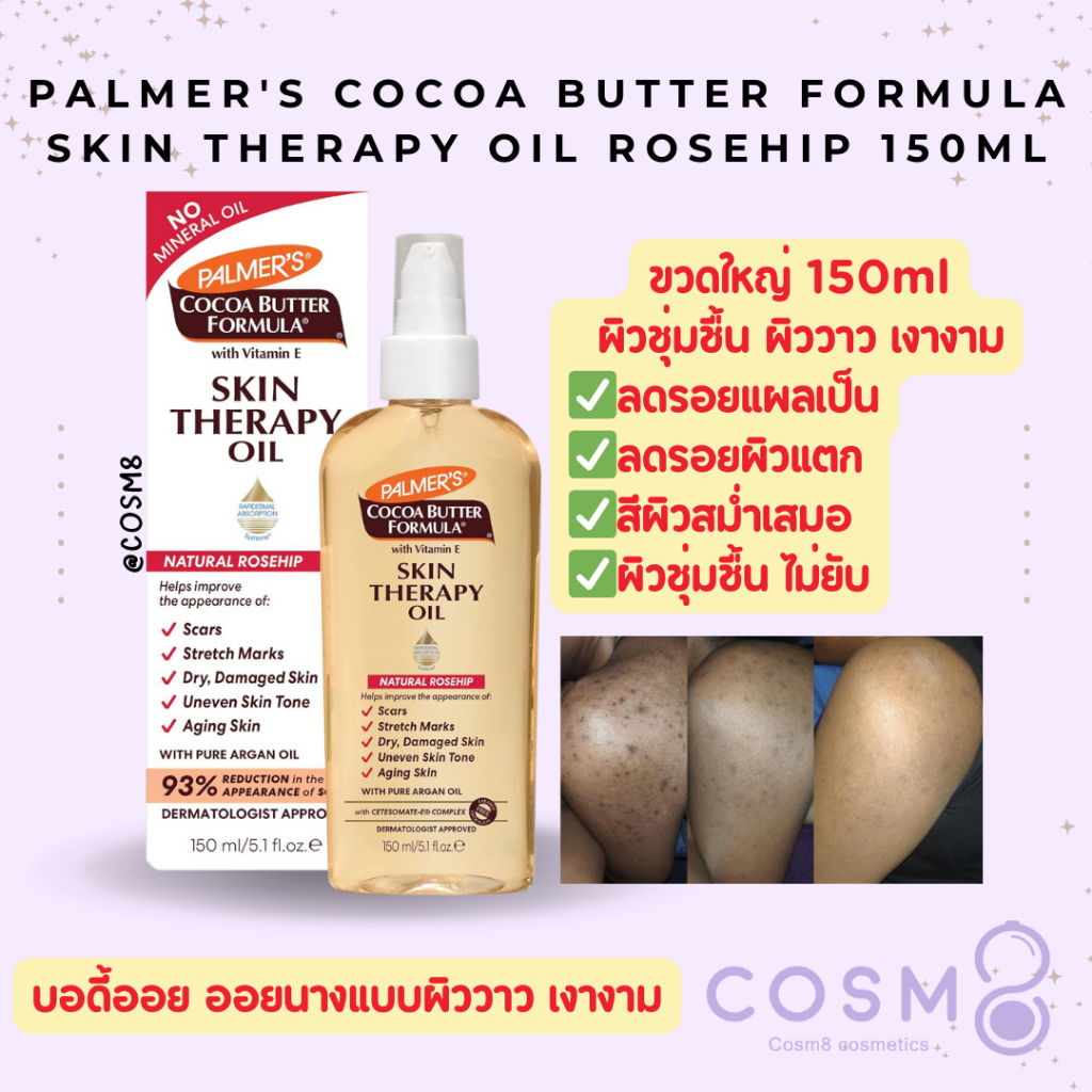 [ใช้โค้ดไลฟ์/Video]✅พร้อมส่ง แพ็คเกจใหม่✅แท้ ออยทาตัวนางแบบ ขวดใหญ่ PALMER'S Cocoa Skin Therapy Oil Rosehip 150 ml