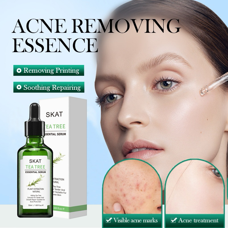 เซรั่มทีทรี SKAT Tea Tree Essential Serum 50ml เซรั่มจากสารสกัดทีทรีเข้มข้น ช่วยป้องกันปัญหาสิว บำรุงผิวหน้าขาวใส N592