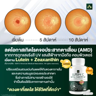 ร้านเจ้าของแบรนด์ ของแท้ ส่งฟรี ลูทีน ซี ( Lutein C )บำรุงดวงตา ช่วยเรื่องตาพร่ามัว ต้อลม ต้อเนื้อ