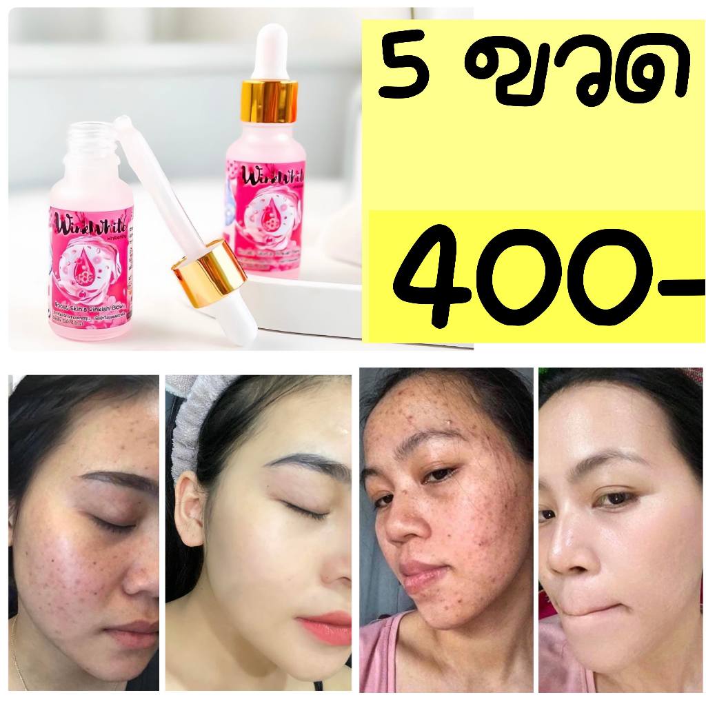 เซรั่มวิ้งไวท์ สูตรซากุระ WinkWhite  (เซรั่มหมอณัฐ )  5 ขวด ❌ราคาปกติ 700 ✅จัดโปรเพียง 400-