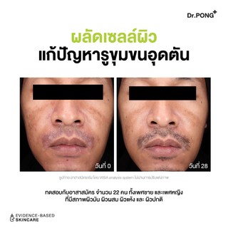 Refill pack 300 ml Dr.PONG p55 BHA Acne Clear face wash เจลล้างหน้าสูตรอ่อนโยน