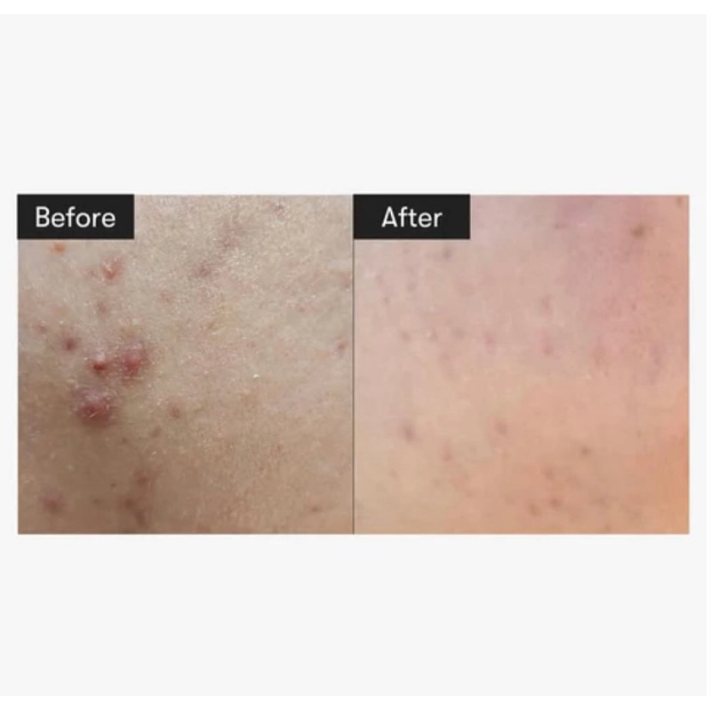 (✅แท้/พร้อมส่ง) VT Reedle Shot 100 🤍 50ml - รูปที่ 5