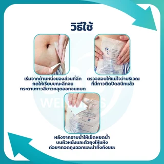 [360wellness อุปกรณ์เพื่อผู้สูงอายุ] (พร้อมส่ง) ถุงอาบน้ำผู้ป่วยไต กันน้ำได้ 100% สำหรับผู้ป่วยล้างไต ใช้แล้วทิ้ง