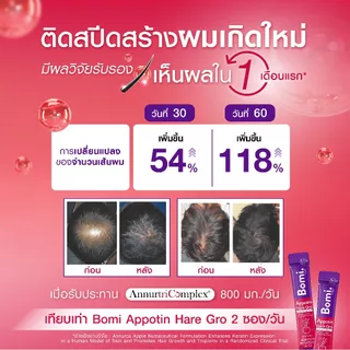 [เซตเห็นผล 4 กล่อง] Bomi Appotin Hare Gro (14x2g) บำรุงเส้นผม เสริมสร้างความแข็งแรงให้กับเส้นผม ลดการหลุดร่วง
