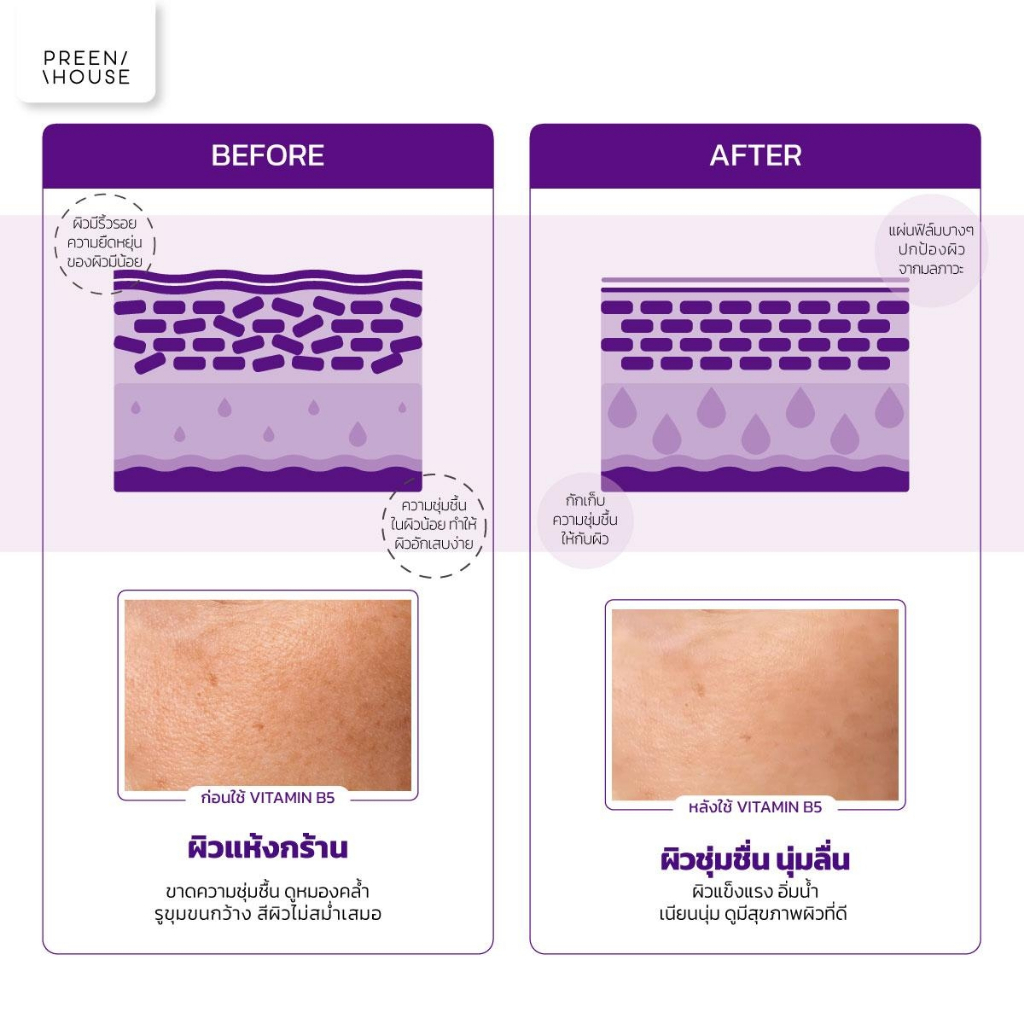 เซรั่มลดริ้วรอย Preenhouse vitamin complex วิตามินบี5 ลดเลือนริ้วรอย เติมน้ำให้ผิว ผิวฉ่ำโกลว์ - รูปที่ 4