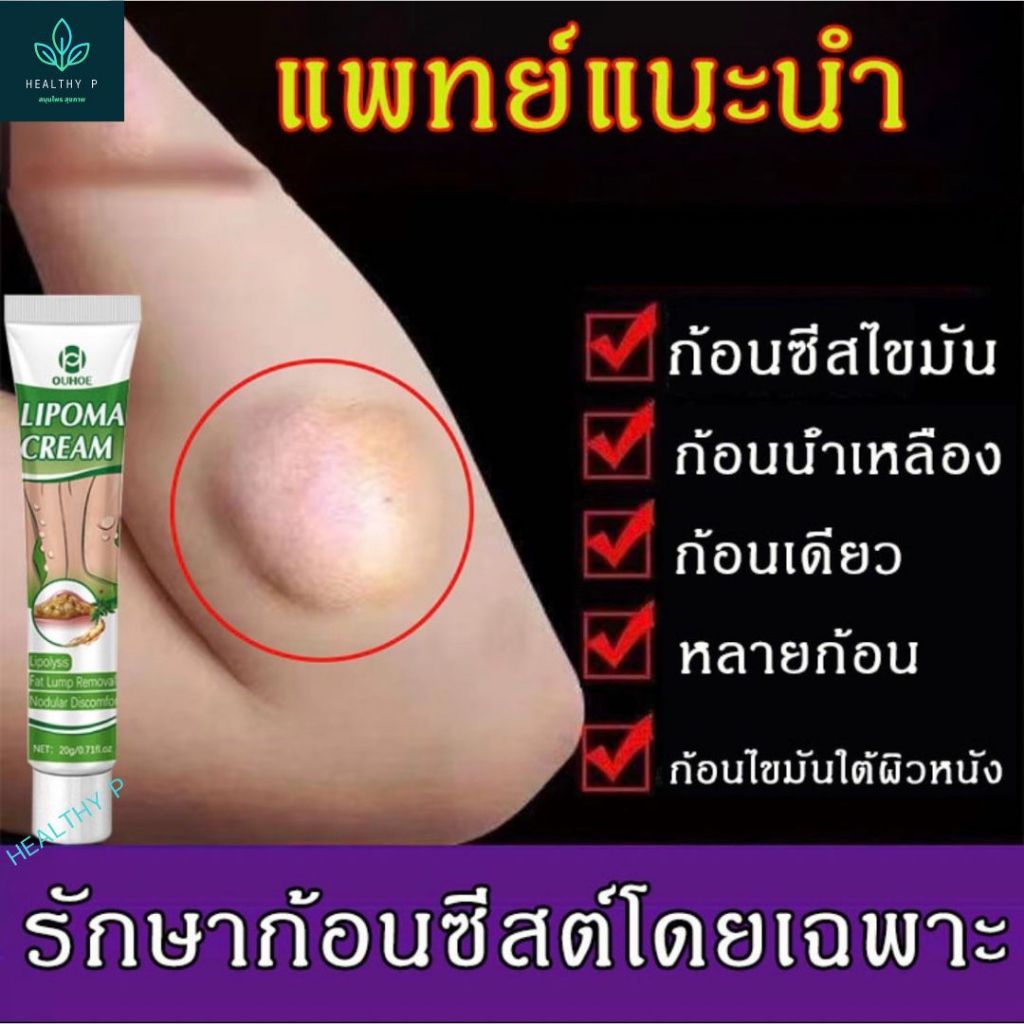 🔥ขายดี แท้ OUHOE🔥 ครีมทา ซี ส ก้อนไขมัน พร้อมส่งทั่ว ส่งไว ส่งฟรี