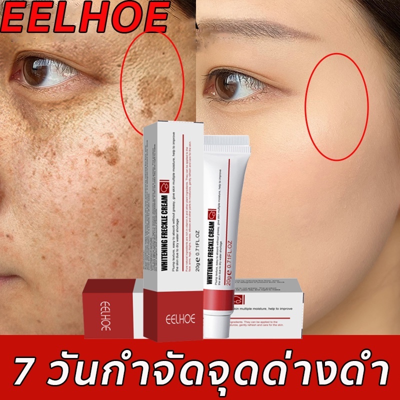 EELHOEครีมไวท์เทนนิ่ง! ไวท์เทนนิ่งครีม กำจัดฝ้า จุดด่างดำ ฝ้า กระ ริ้วรอย ครีมรักษาฝ้า ลดเม็ดสีเมลานิน whitening crea