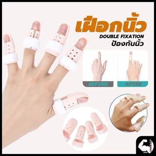 เฝือกนิ้ว mallet finger สำหรับนิ้วล็อค มือพลาสติกสีเนื้อ ป้องกันการงอข้อปลายนิ้ว ใช้ดามนิ้วสำหรับการรักษา