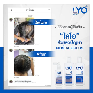 [ส่งฟรี] LYO ไลโอ แชมพู ครีมนวด แฮร์โทนิค แก้ผมบาง หัวล้าน ลดผมร่วง ขจัดรังแค ชะลอผมหงอก ของแท้ 100%