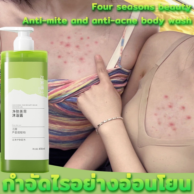 ครีมอาบน้ำกำจัดไร 400ML เจลอาบน้ำลดสิว ขจัดไรและสิ ลดสิว ต่อต้านเชื้อรา กำจัดไร อ่อนโยนไม่ระคายเคือง สบู่ลดสิว
