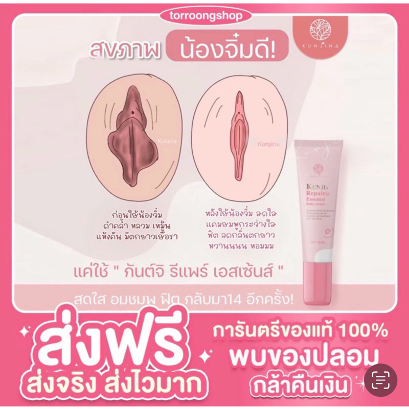 ส่งฟรี (ปิดชื่อสินค้า) kunjirepair กันจิรีแพร ของแท้100% น้ำตบดูแลน้องสาว กระชับ ลดอาการคัด ตกขาวหาย ลดกลิ่นอัพ เหม็นคาว