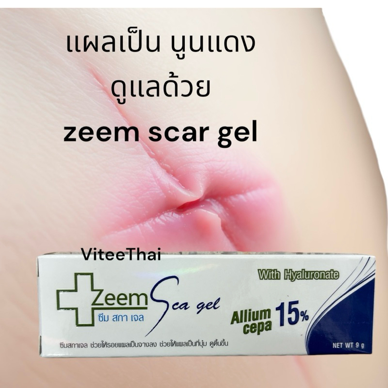 Zeem Scar Gel Allium Cepa 15% ซีม สการ์ เจล ดูแลปัญหาแผลเป็นทุกประเภท 15 กรัม