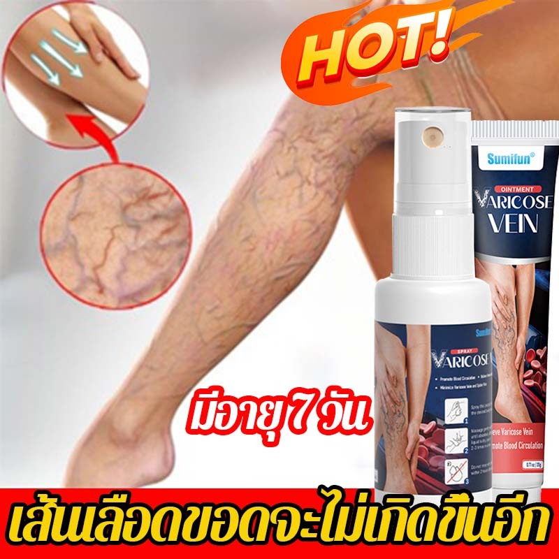 แท้100% ครีม ทา เส้นเลือดขอด ของแทั เส้นเลือดฝอยแตก ครีมทาเส้นเลือดขอด ส่งเสริมการไหลเวียนโลหิต