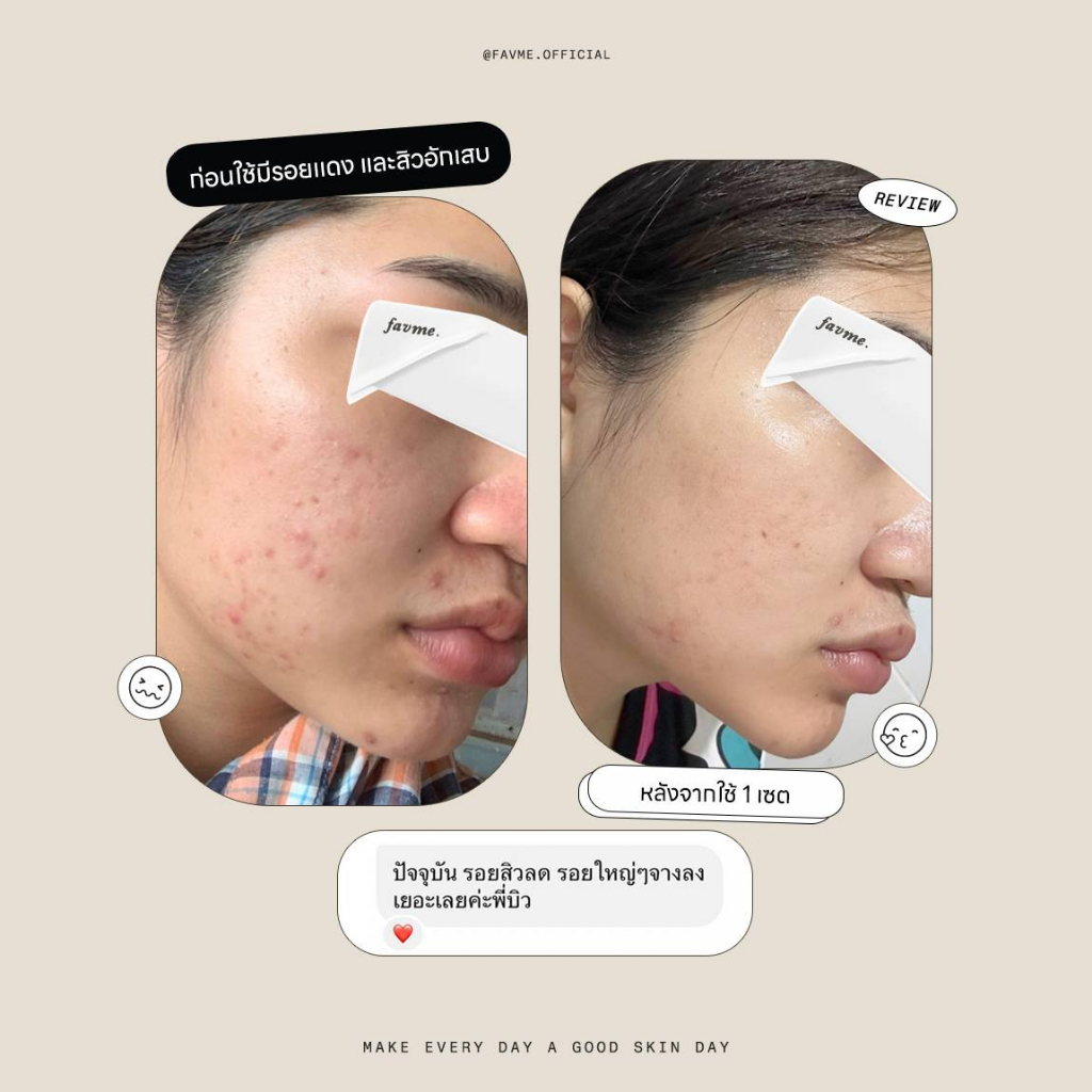 Lovelist เซตลดรอย เซรั่ม Fully Shine + ครีม Moon Night Cream - รูปที่ 6