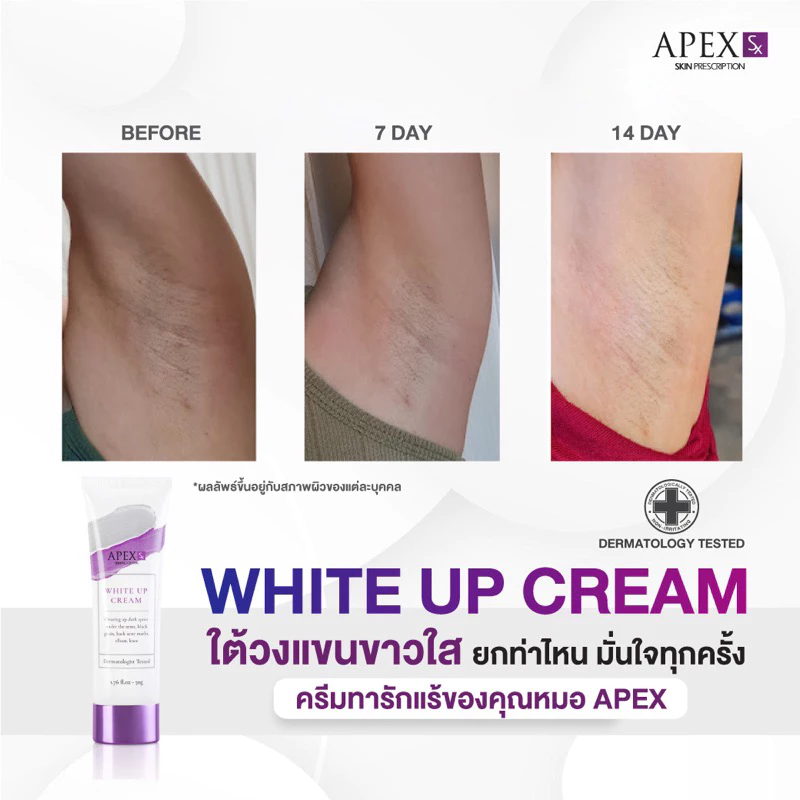 APEX-SX WHITE UP CREAM ครีมทารักแร้ขาว โดยแพทย์ผิวหนังเอเพ็กซ์ ทาขาหนีบดำ แก้มก้นดำ 50 ml. thumbnail 7
