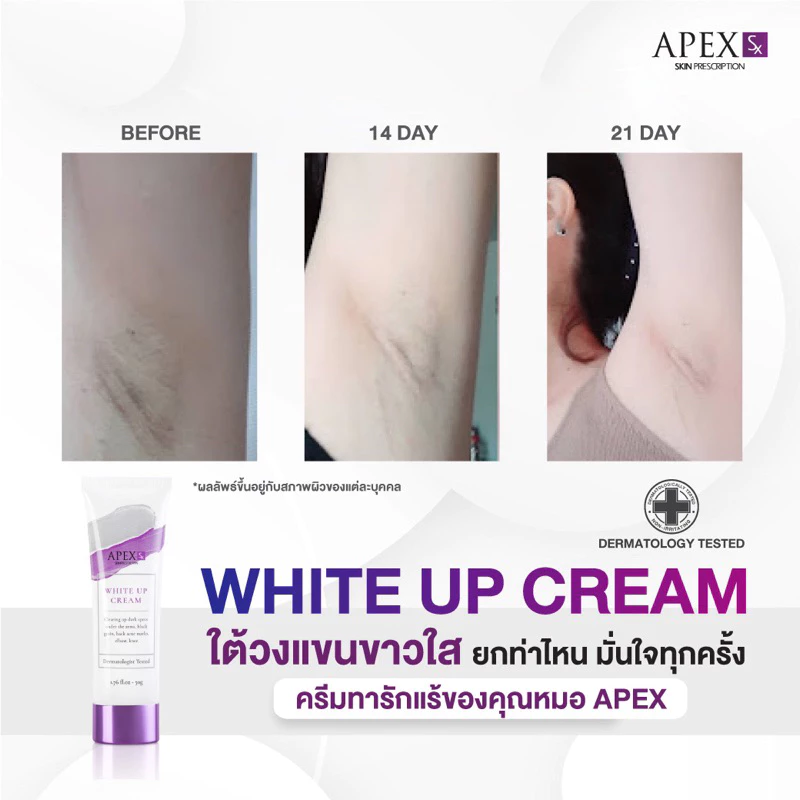 APEX-SX WHITE UP CREAM ครีมทารักแร้ขาว โดยแพทย์ผิวหนังเอเพ็กซ์ ทาขาหนีบดำ แก้มก้นดำ 50 ml. thumbnail 9