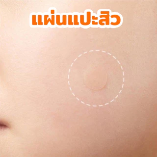 แผ่นแปะสิว ช่วยลดอาการอักเสบให้ยุบไว Salicylic Acid ช่วยดูดสิว รักษาสิว ขอบบาง กันน้ำ แต่งหน้าเนียน มี 36 ชิ้น
