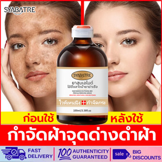 ครีมทาฝ้า SYABATRE 100ml ครีมถาหน้าขาว ครีมทาฝ้าหนาๆ ช่วยกำจัดฝ้ากระ/จุดดำ/ฝ้าถูกแดดเผาอย่างเป็นมืออาชีพ ทำให้ผิวขาวกร