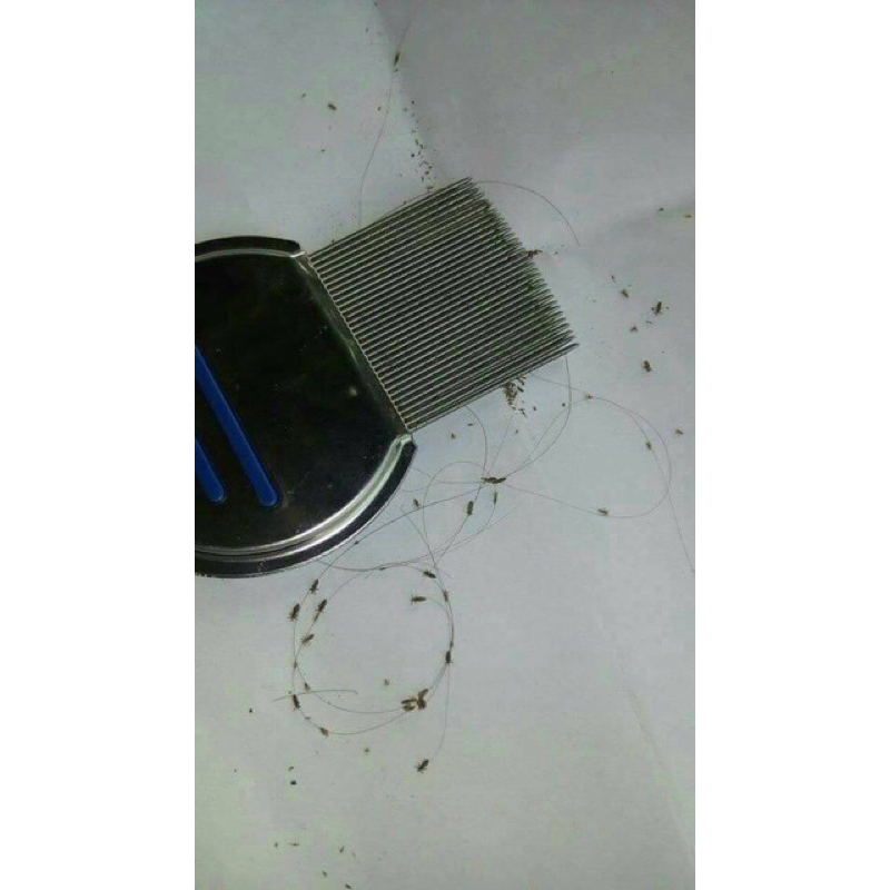 หวีสางเหา หัวหลุดหระจาย กำจัดเหา แปรงหวีตัวเหา หวีสแตนเลสสางตัวเหา ไข่เหา - รูปที่ 4