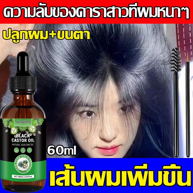 【บรรจุภัณฑ์ใหม่】ล๊อตล่าสุด เซรั่มปลูกผม รักษาผม น้ํายาเร่งผม น้ำยาปลูกผมผู้ชาย สเปรย์ปลูกผม บำรุงรากผม ป้องกันผมร่วง
